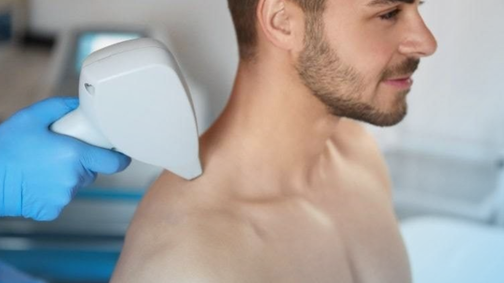 depilación laser masculina